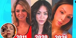 Sheyla Rojas se opera una vez más: mira el resultado de su nueva nariz