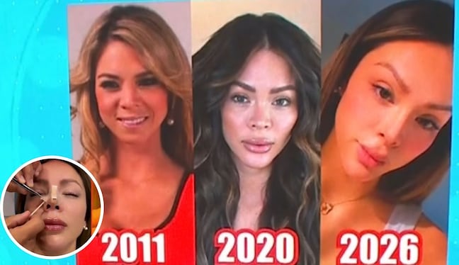 Sheyla Rojas se opera una vez más: mira el resultado de su nueva nariz
