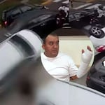 ¡Lo embistió y volcó! Terapeuta de UCI queda con los brazos fracturados tras ser atropellado en Jesús María