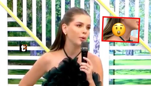 Brunella Horna aparece con marca en el cuello