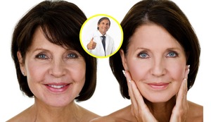 ¿Es recomendable usar los bioestimuladores faciales para rejuvenecer el rostro? Lee la columna del cirujano Jean-Paul Osores Bianchi