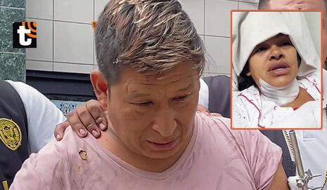 Intento de feminicidio en Ate: salvaje le corta el cuello a su pareja por visitar a hijos de su exconvivi...