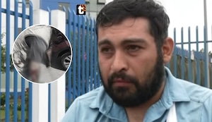 ¡Brutal ataque! Extorsionador corta el brazo a parqueador por negarse a pagar cupo en Ate