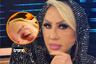 Laura Bozzo sufrió fuerte accidente y su rostro quedó con moretones: “Tuve una crisis de ansiedad”