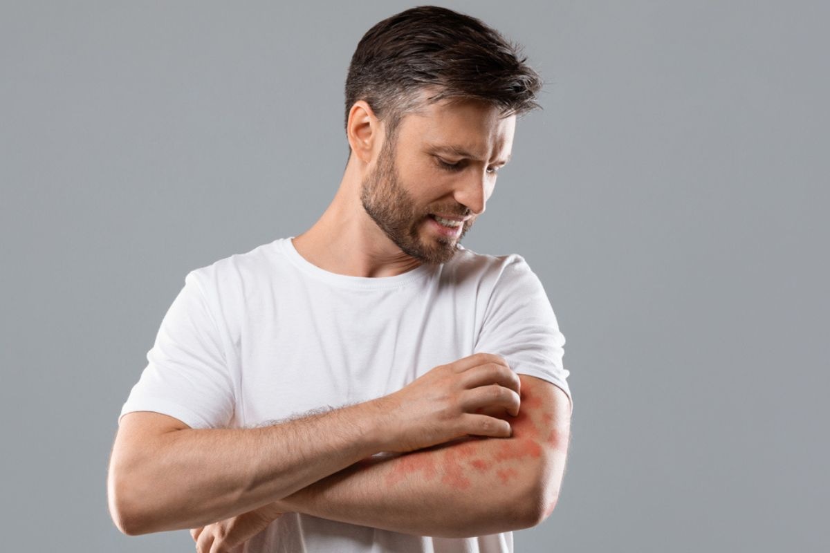 Los betacarotenos intervienen en la formación y mantenimiento de las células de la piel, así como también en la hidratación, protección y regulación de esta. Foto: iStock.