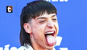 ¿Por qué tienes la lengua de color blanco a pesar de tener buena higiene bucal? Conoce las causas