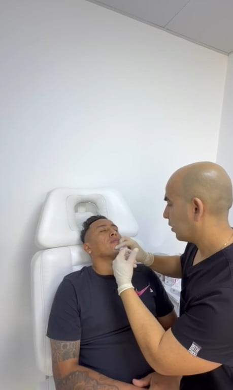 Christian Cueva se somete a tratamiento de masculinidad.