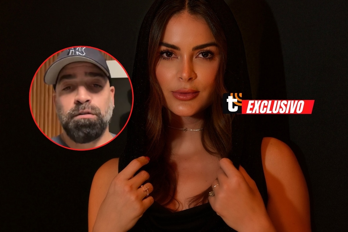 TROME - Modelo ya fue operada, según revela su esposo Brian Rullan.