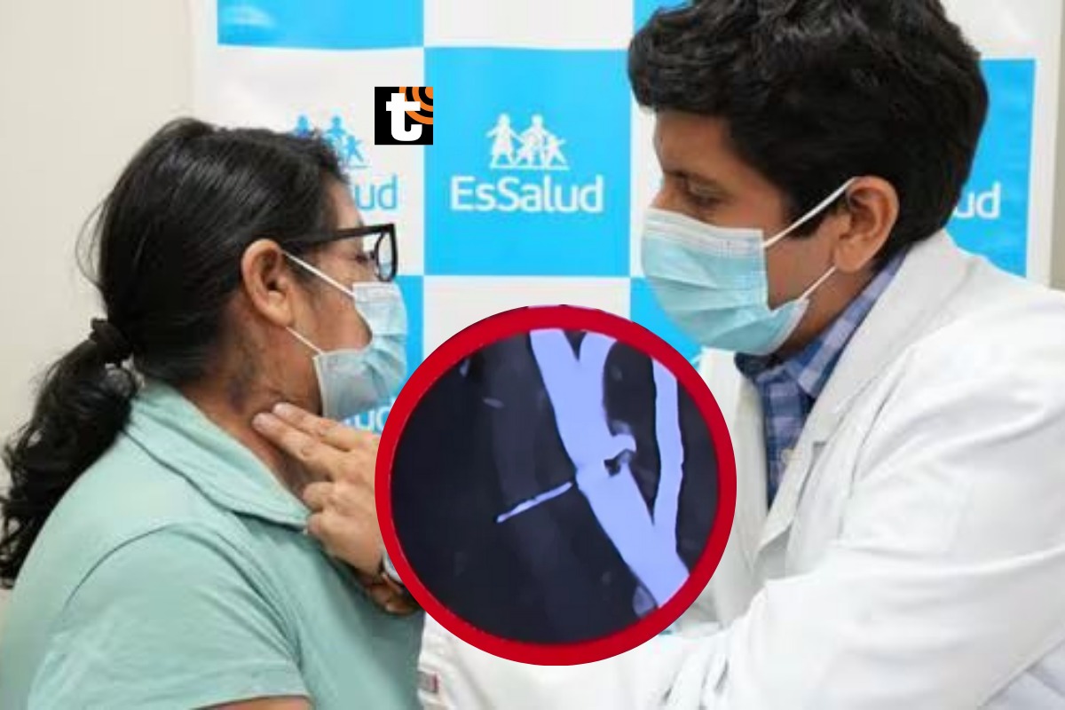 Mujer sobrevivió con un clavo incrustado en la arteria por más de 40 días. (Foto: Difusión)