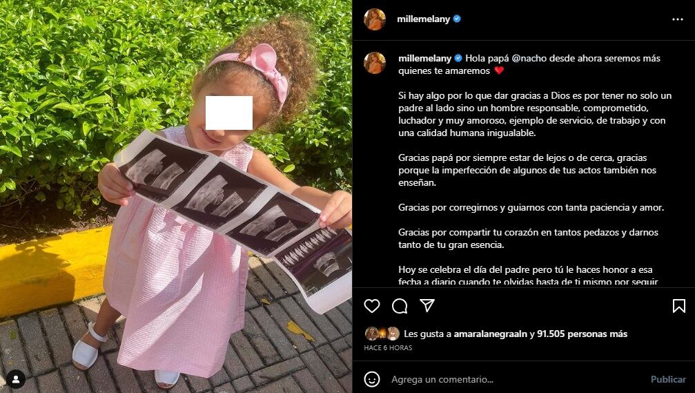 Nacho se convertirá en padre. (Foto: @millemelany).