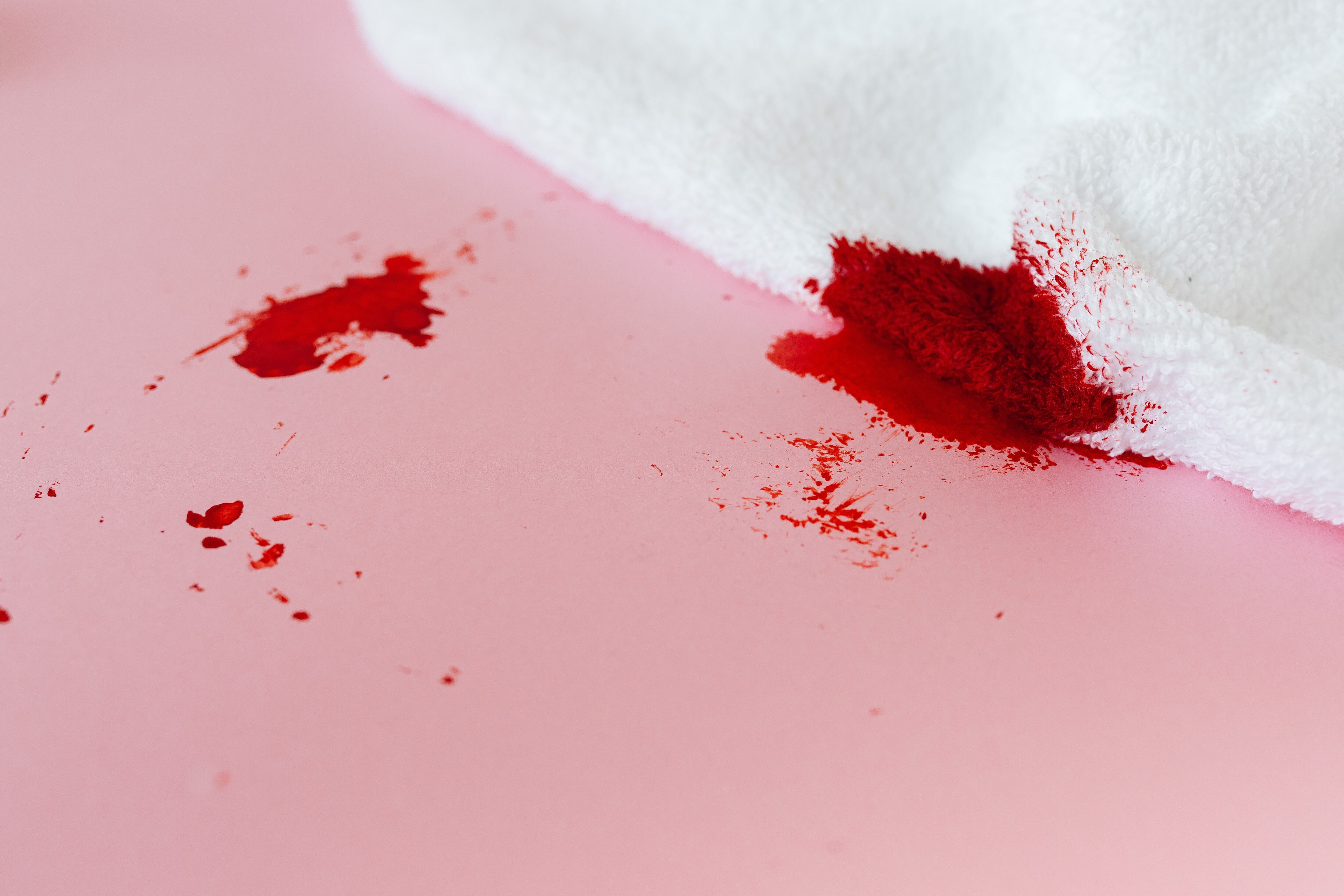 Hay productos que funcionan bastante bien para quitar manchas de sangre de la ropa. (Foto: Pexels)