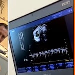 Carol Real y André Bankoff se emocionan con latidos de su bebé