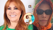 Magaly se defiende tras ser ‘troleada’ por su cirugía en la cara: “Ni me han quitado los puntos”