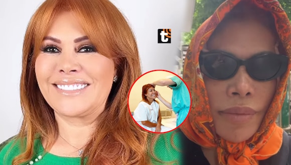 TROME- Magaly se defiende tras ser ‘troleada’ por su cirugía en la cara: “Ni me han quitado los puntos”