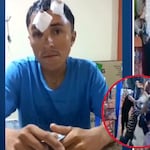 Piura: hombre recibe brutal ataque con sillas en discoteca