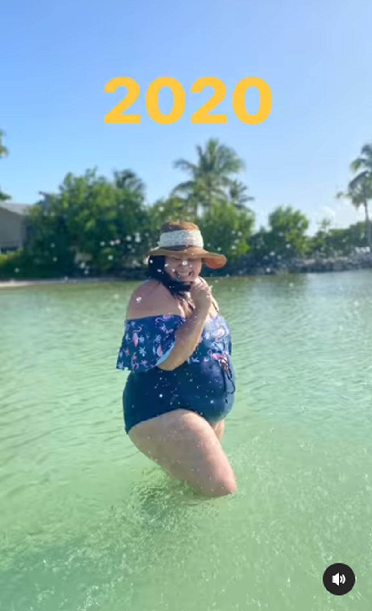 Imágenes de cómo lucía la actriz antes de la intervención quirúrgica (Foto: Gisella Aboumrad / Instagram)