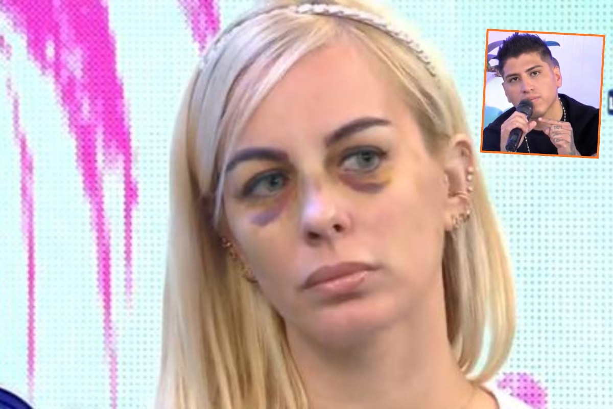 Dalia Durán denuncia nueva agresión de John Kelvin. (Captura Willax/ Redes sociales)