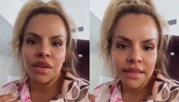 Jossety, hija de Andrés Hurtado, descarta 'canjes' en su cirugía del busto: "Yo he pagado totalmente esta operación"