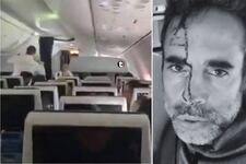 ¡Terror en vuelo de Flydubai rumbo a Israel! Copiloto habría apuñalado al piloto e intentado estrellar el avión