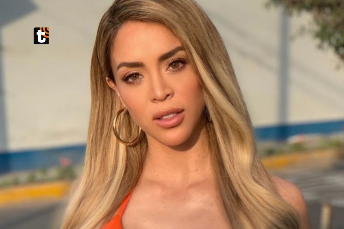 Sheyla Rojas se sometió a retoquito estético.