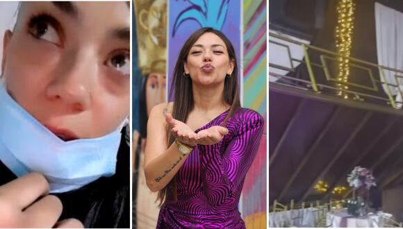 Suu Rabanal se pronuncia tras accidente durante concierto