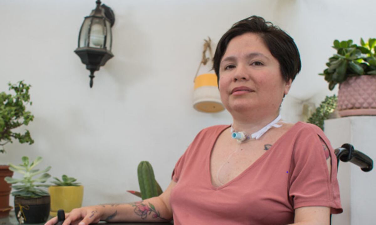 Ana Estrada, paciente de polimiositis, murió el domingo 21 de abril. (Foto: Difusión)