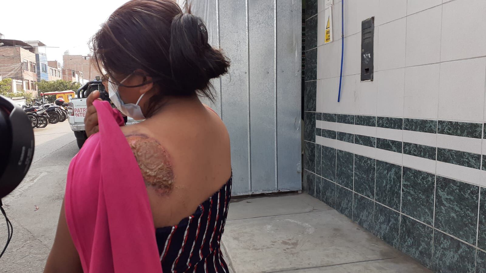 Madre de familia da detalles del violento atraco que fue víctima cuando fue arrastrada por unos delincuentes en mototaxi para robarle su celular y dinero de su negocio. (foto TROME)