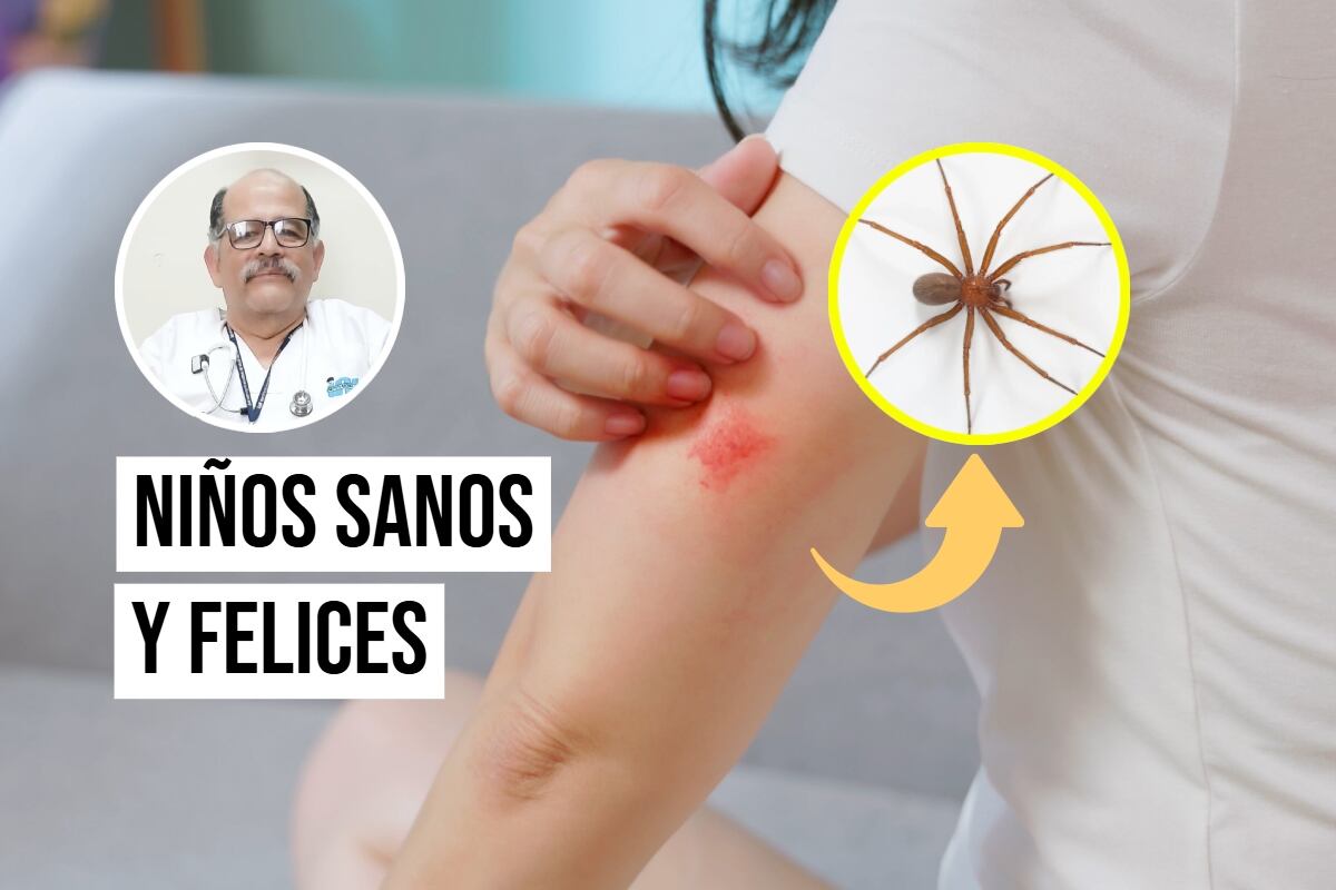 ¿Cómo saber si una araña mordió a tu hijo y qué síntomas debes observar?
