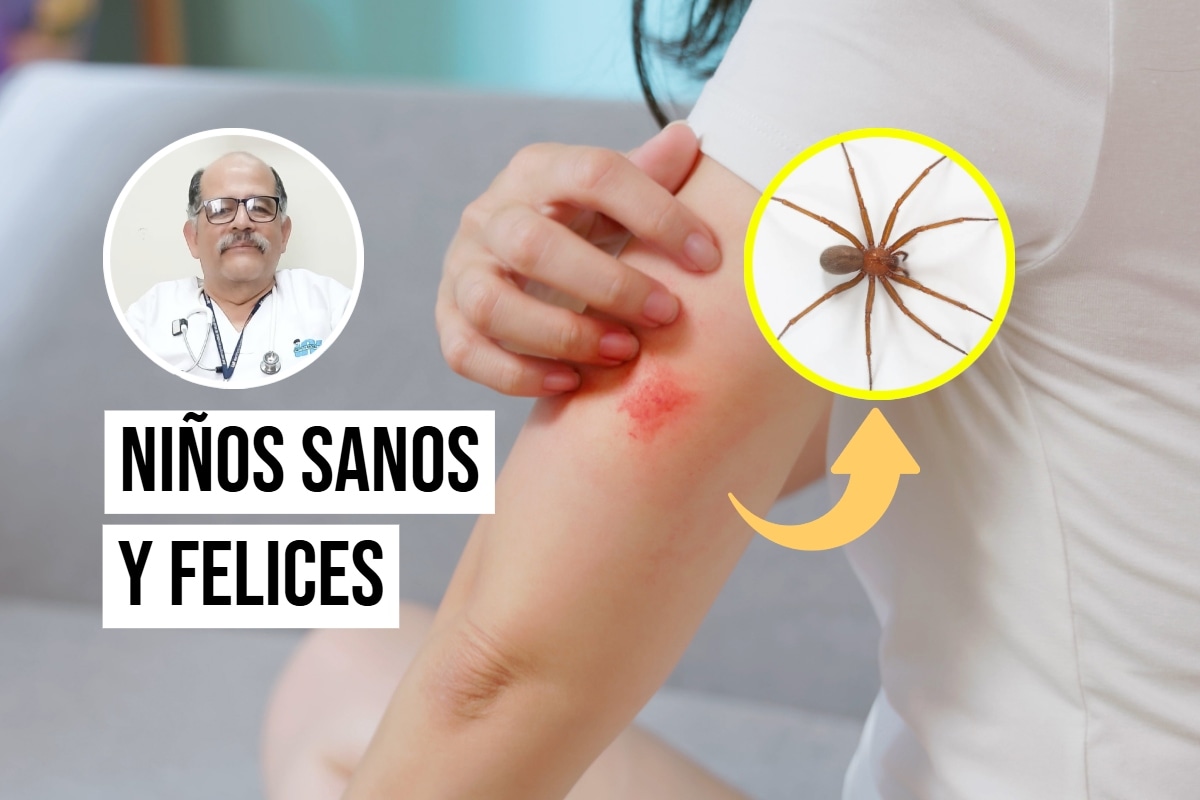 Las mordeduras de araña pueden causar enrojecimiento, dolor y otras complicaciones. Foto: Composición / Istock.