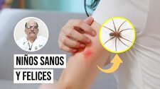 ¿Cómo saber si una araña mordió a tu hijo y qué síntomas debes observar?
