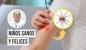 ¿Cómo saber si una araña mordió a tu hijo y qué síntomas debes observar?
