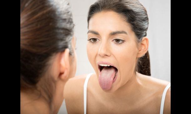 ¿Por qué tengo la lengua blanca?