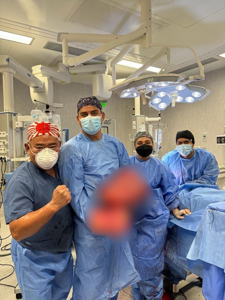 Médicos cirujanos Roberto Solari, César Nagatome, Nahir Tasayco y Erick Marroquín lograron exitosa operación para retirar tumor de 35 kilos.