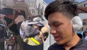 ¡Salvaje ataque en Chosica! Ambulante le arrancó parte de la oreja a un sereno durante violento operativo