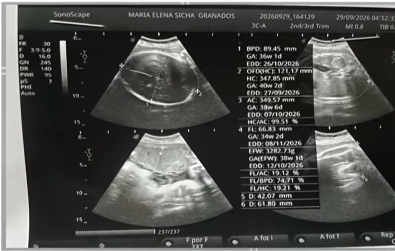 Madre denuncia robo de una de sus gemelas en hospital Carrión del Callao. Foto: Cuarto Poder