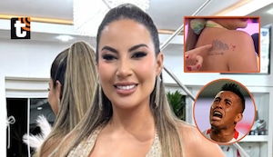 Pamela López inicia tratamiento para borrarse tatuaje de Cueva: ¿cuál es el exorbitante costo del procedimiento?