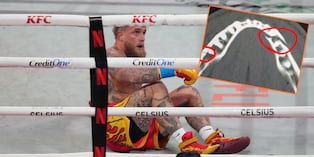 Jake Paul mostró la fractura que sufrió por golpe de Anthony Joshua. ( Agencias/ @jakepaul)