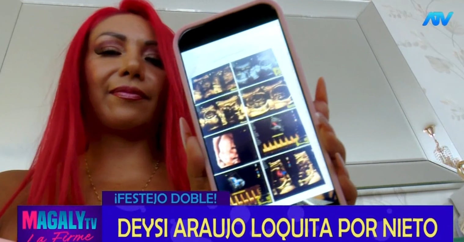 Deysi Araujo dice que la noticia del embarazo de la novia de su hijo le cayó como un balde de agua fría.
