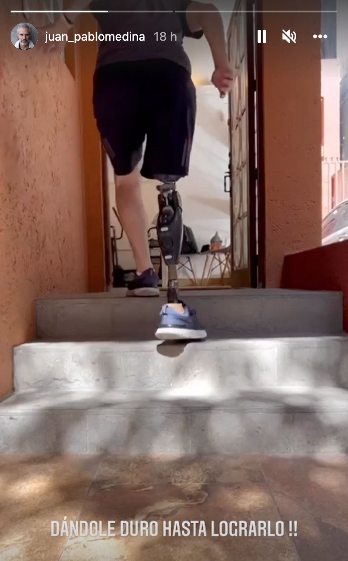 El artista estadounidense mostró en una historia de Instagram cómo aprende otra vez a subir las escaleras (Foto: Juan Pablo Medina / Instagram)