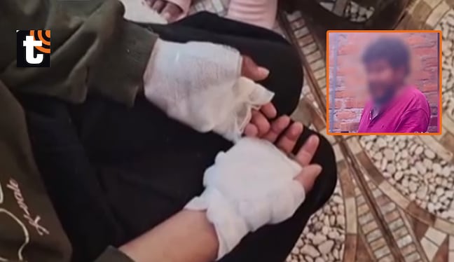 ¡Violencia sin límites! Niña de 11 años es rescatada tras ser maltratada y quemada por su padrastro