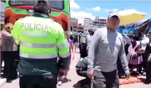 Cusco: Menor de tres años termina con las piernas amputadas tras ser atropellada por bus