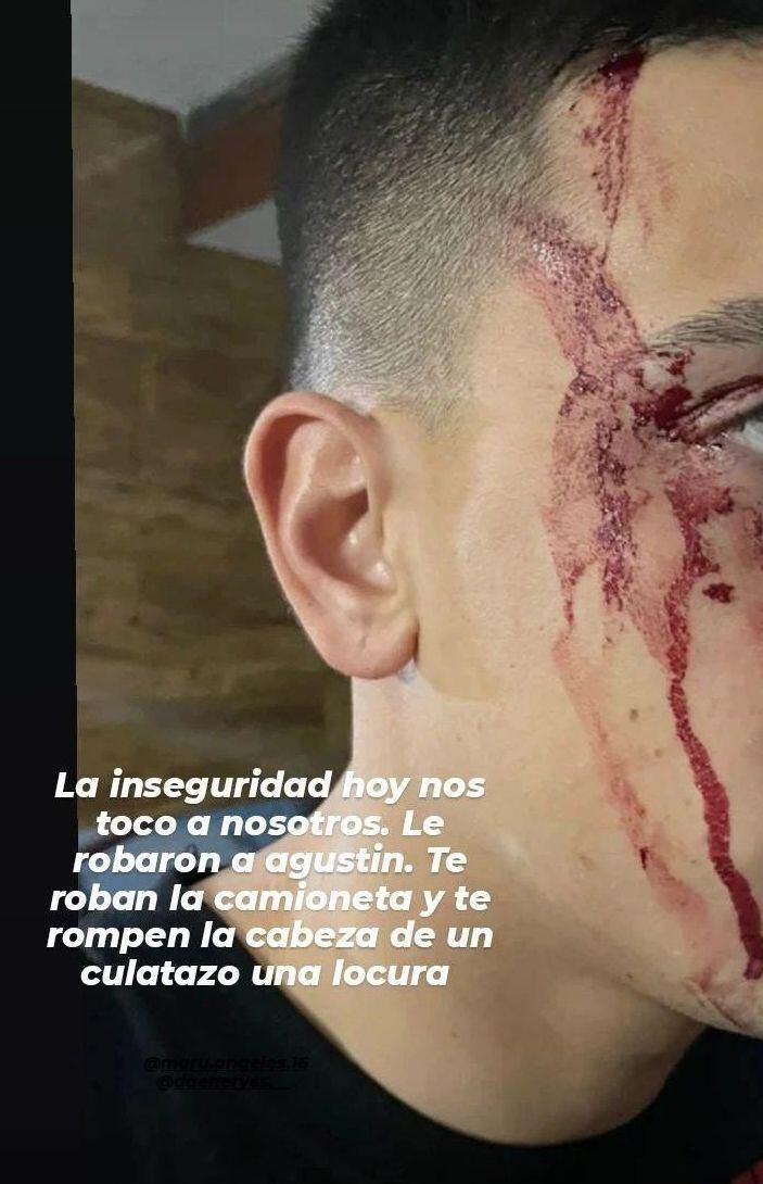 Así quedó Agustín Sández tras el ataque. (Instagram)