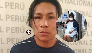 ¡Horror en el Callao! Sujeto le arranca la nariz a su expareja de un mordisco por no querer retomar la relación