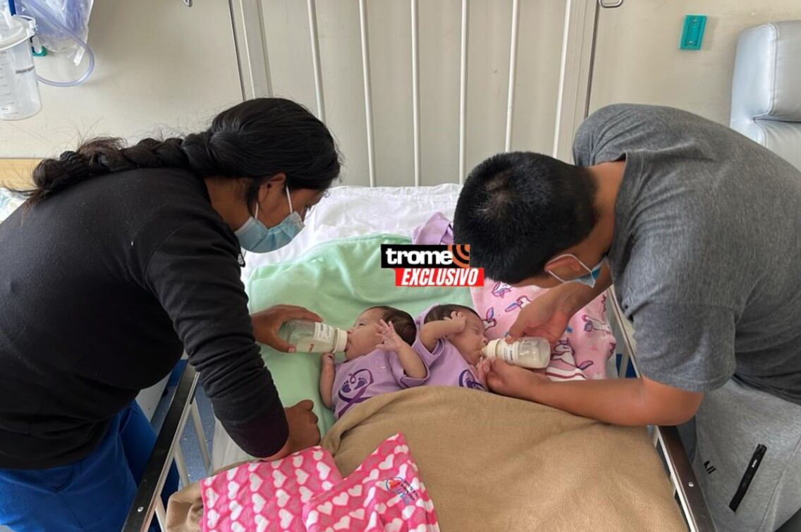 Ambas bebés prematuras y siamesas reciben la atención y amor de sus padres. (INSN-San Borja / Isabel Medina / Trome).