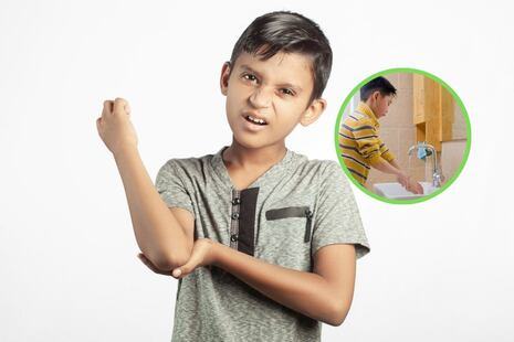 Primeros auxilios: ¿Qué hacer si tu hijo sufre una quemadura?