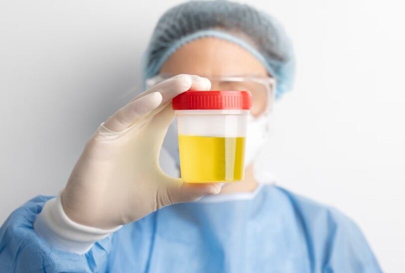 Antes de recetar una medicación, el médico enviará una orden de exámenes de orina, tomografía y otros para conocer las causas de la infección. Foto: Pinterest.