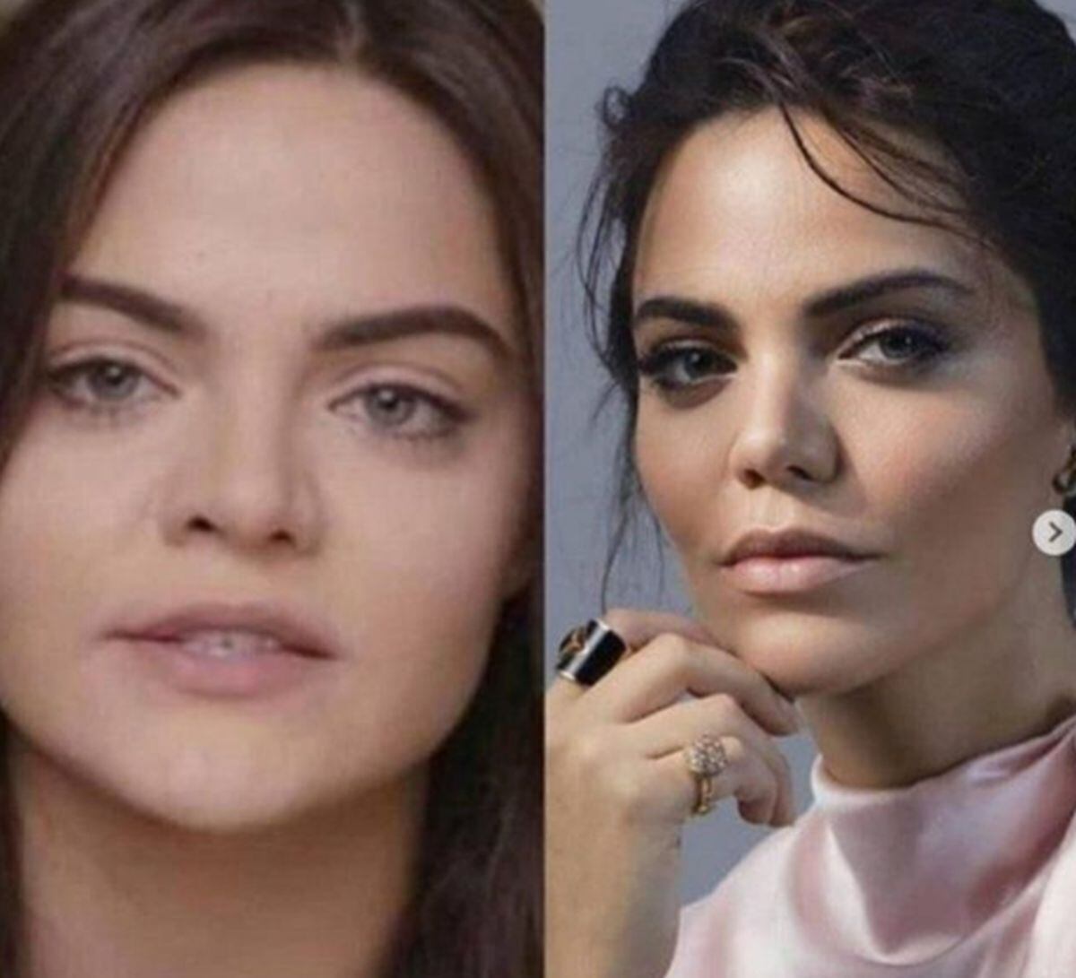 En esta imagen de Hilal Altınbilek se puede apreciar el cambio físico que ha tenido en los últimos años (Foto: Haberler Ankara/Twitter | Hilal Altınbilek/Instagram)