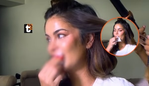 Laura Spoya sigue con diente fracturado tras aparatoso choque y revela por qué aún no puede operarse