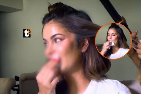 Laura Spoya sigue con diente fracturado tras aparatoso choque y revela por qué aún no puede operarse