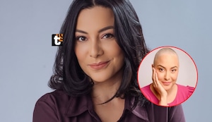 Natalia Salas explota contra las marcas que fingen cicatrices: “Me parece una burla y una falta de respeto”